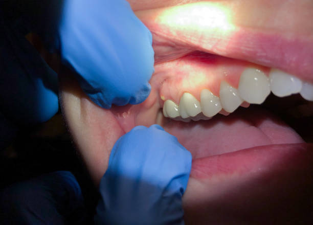Best Emergency Broken Tooth Repair in Crosby, MN
